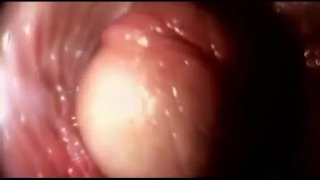 Камера внутри вагины после внутреннего кремпая, и бритье киски
